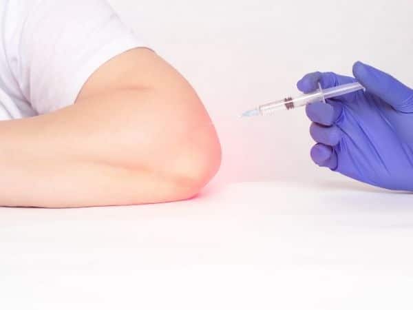 injekcije kortikosteroidi zglob