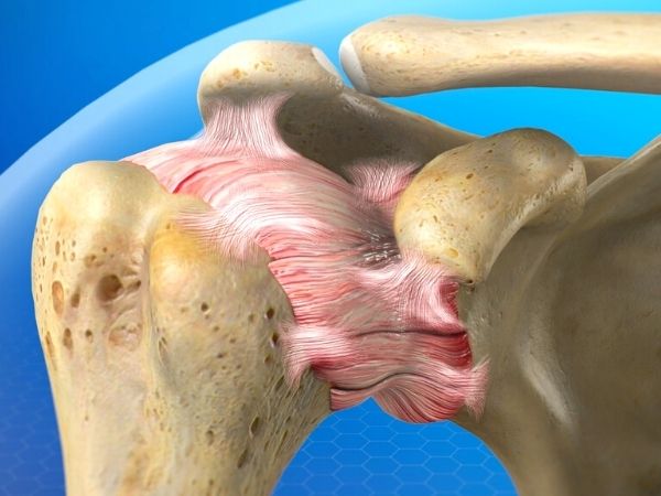 artroza koljena lijekovi za liječenje 4 stupnja